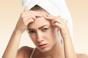 acne scar treatment in kottayam | best skin clinic in kottayam